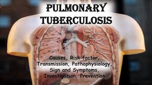 Steady Homeopathic Treatment for Pulmonary Tuberculosis-Life Homeo Care